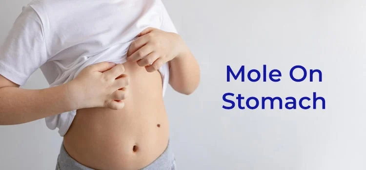 Mole On Stomach
